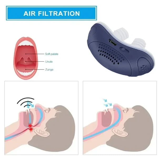 Schlaflos, Maskenlos, Mikro-CPAP Anti-Schnarchgerät