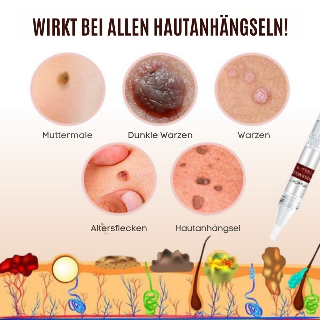 Wipe-off Maulwurfs- und Fleckenentferner