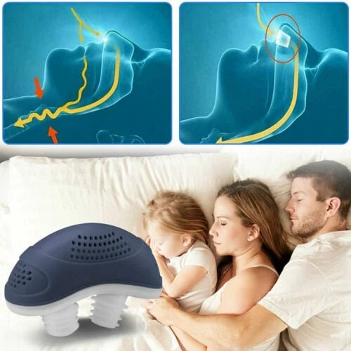 Schlaflos, Maskenlos, Mikro-CPAP Anti-Schnarchgerät
