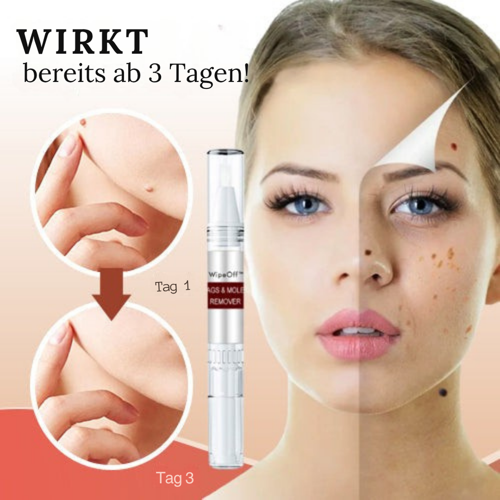 Wipe-off Maulwurfs- und Fleckenentferner