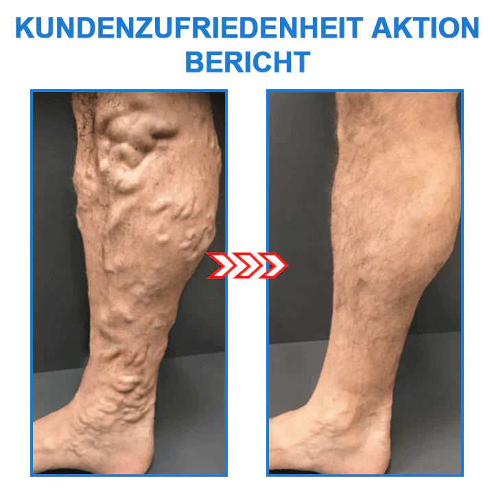 1+2 Gratis | FormSocken - Schlanke Beine und straffe Haut in einem Schritt!