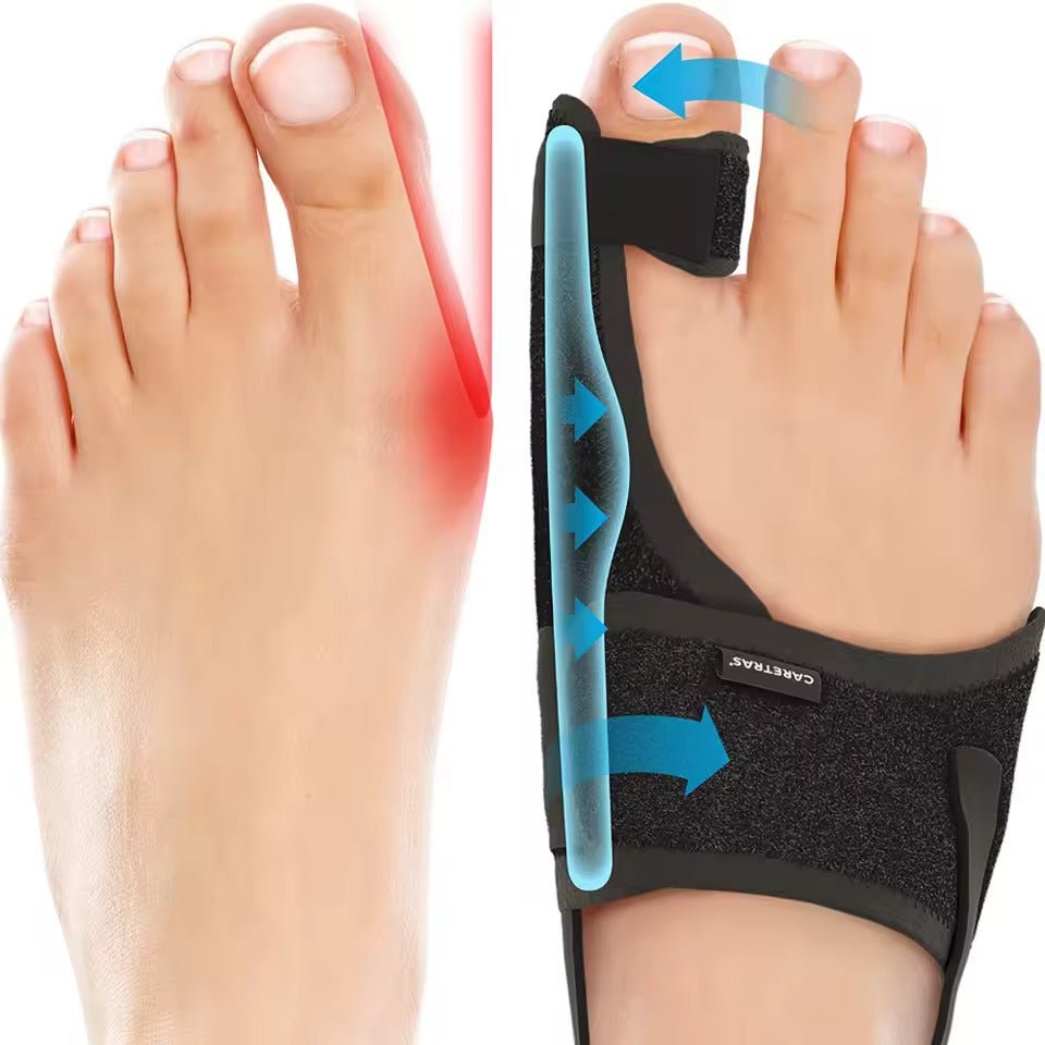 Nachtschiene Hallux Valgus - Ergonomischer und verstellbarer Komfort