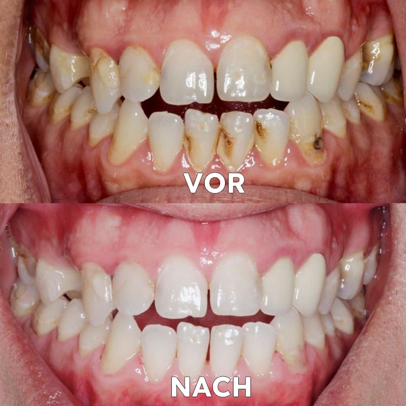 Mineral-Pulver für die Zahnpflege | Stärkt & schützt Zähne | SmileProtection