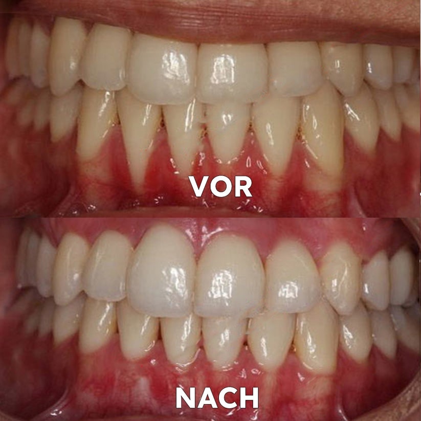Mineral-Pulver für die Zahnpflege | Stärkt & schützt Zähne | SmileProtection