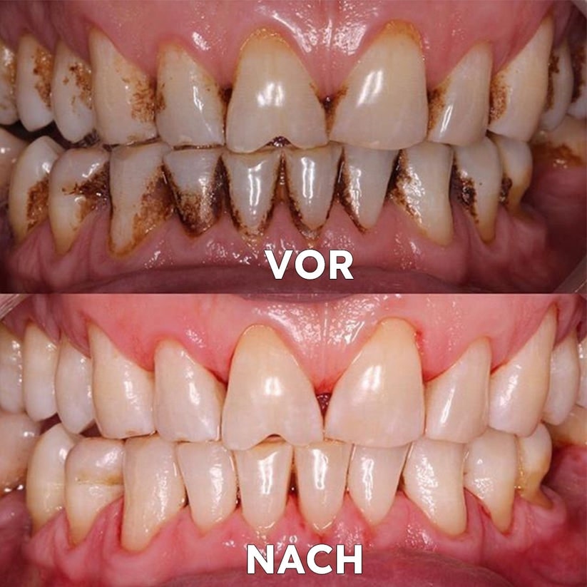 Mineral-Pulver für die Zahnpflege | Stärkt & schützt Zähne | SmileProtection